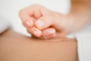 Akupunktura przeciwwskazania
